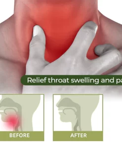 MEDix™ Sore Throat Cream