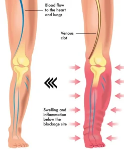 Magnetic LymphTherapy Detox Bracelet