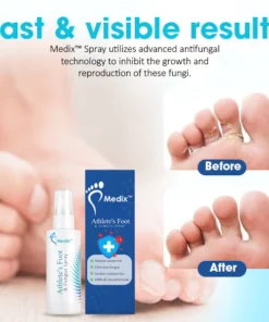 Alternative view of Medix™ Athlete's Foot & Fungus Spray