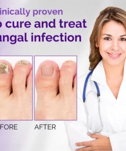 NailClear™ Nail Fungal Essence