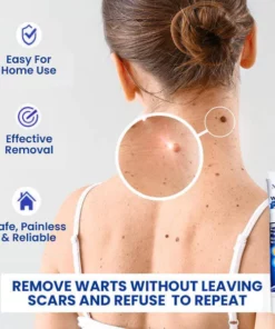 Neigeuses™ WartsOff Instant Blemish Removal Cream
