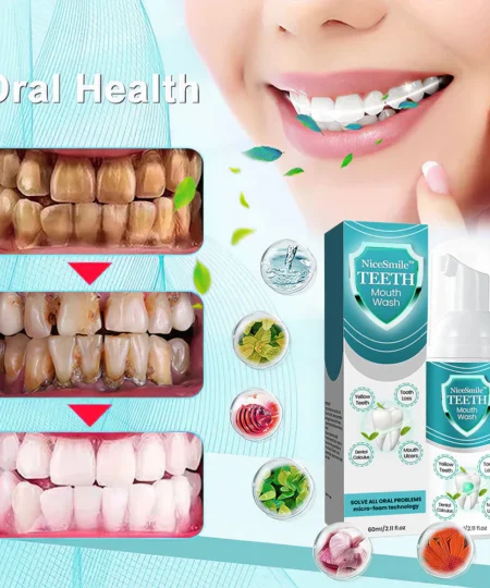 NiceSmile™ TEETH Mouthwash - Solve All Oral Problems