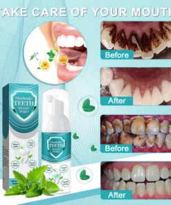 NiceSmile™ TEETH Mouthwash - Solve All Oral Problems