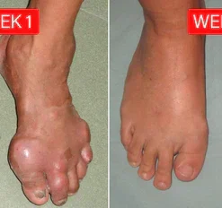 Nurbini™ ArthriBee Joint and Bone Therapy Cream