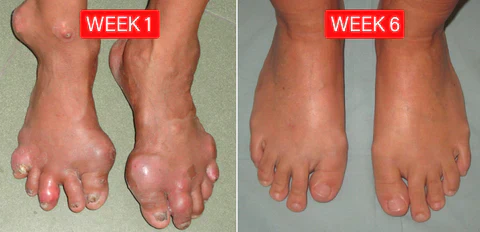 Nurbini™ ArthriBee Joint and Bone Therapy Cream