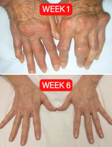 Nurbini™ ArthriBee Joint and Bone Therapy Cream