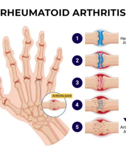 Nurbini™ ArthriBee Joint and Bone Therapy Cream