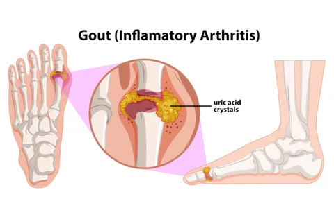 Nurbini™ ArthriBee Joint and Bone Therapy Cream