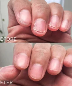 Nurbini™ Bee Venom Toenail Serum