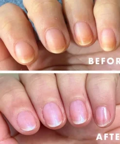 Nurbini™ Bee Venom Toenail Serum