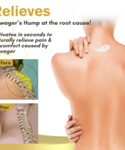 NutRelief™ Bee Venom Dowager Treatment Cream