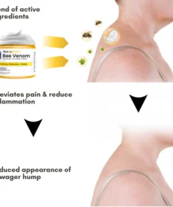 NutRelief™ Bee Venom Dowager Treatment Cream