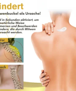 NutRelief™ Bienengift Witwe Behandlungscreme