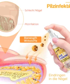 Ourlyard™ Bienengift Nagelpilz Behandlungsspray