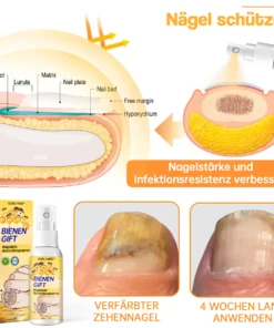Ourlyard™ Bienengift Nagelpilz Behandlungsspray