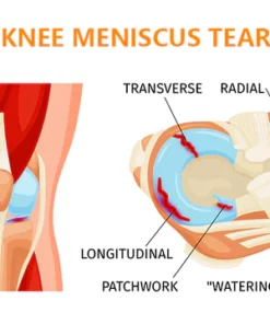 OveallgoTM Bee Venom Joint & Bone Therapy Spray