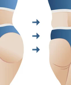 Oveallgo™ BumUP Bee Venom Butt Enhancer Cream