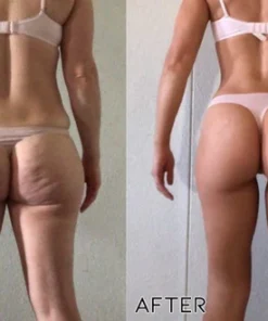 Oveallgo™ BumUP Bee Venom Butt Enhancer Cream