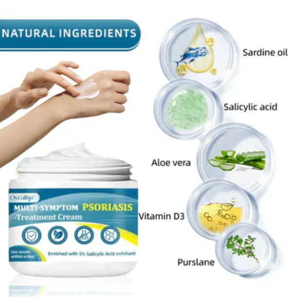 Oveallgo™ Multi-Symptom Psoriasis Treatment Cream