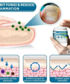 Oveallgo™ Multi-Symptom Psoriasis Treatment Cream