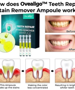 Alternative view of Oveallgo™ PRO Teeth Repair Stain Remover Ampoule