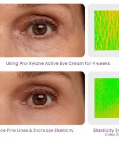 Oveallgo™ Pro-Xylane Active Eye Cream