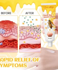 Oveallgo™ PsoriX Bee Venom Cream
