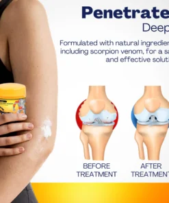 Oveallgo™ Scorpi Venom Relief Cream