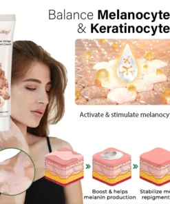 Oveallgo™ Squalene Vitiligo Treatment Cream