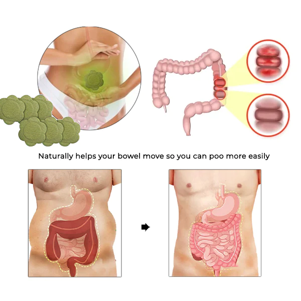 Oveallgo™ TruLax Constipation Patch - Image 4