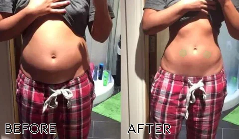 Oveallgo™ TruLax Constipation Patch - Image 5