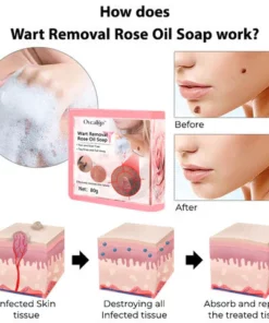 Oveallgo™ Wart NanoPURI Removal Rose Oil Soap