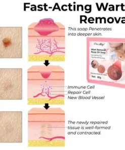 Oveallgo™ Wart NanoPURI Removal Rose Oil Soap