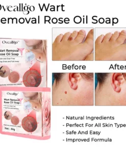 Oveallgo™ Wart NanoPURI Removal Rose Oil Soap