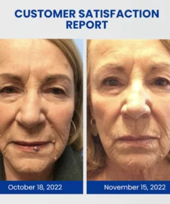 Oveallgo™ WartsOff NanoPURI Instant Blemish Removal Cream