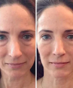 Oveallgo™ Youth Magic Essence Mist