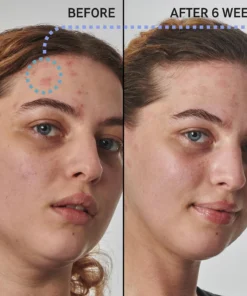 Peptide Moisturizer - Suitable for All Skin Types