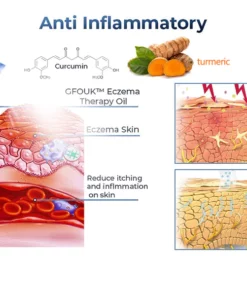 PsoriaGone™ Psoriasis relief spray