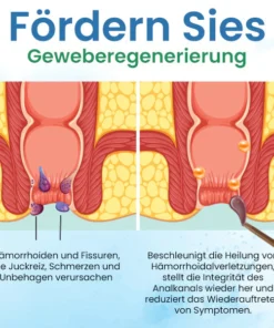 Quezy™ Hämorrhoiden Behandlung Gel