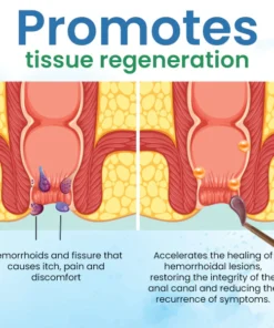 Quezy™ Hemorrhoids Treatment Gel