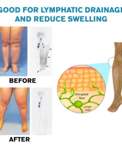 Alternative view of Ricpind EMS SwellReduce DetoxTherapeutic Massager