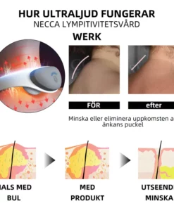 Alternative view of Ricpind Ultraljud Lymfvårds Nacken Enhet