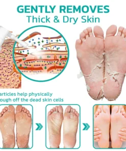 Seurico™ Professional Callus Remover Extra Strength Spray