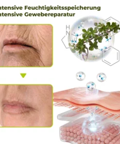 flysmus™ Auferstehungs-Erneuerungs-Creme