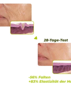 flysmus™ Auferstehungs-Erneuerungs-Creme