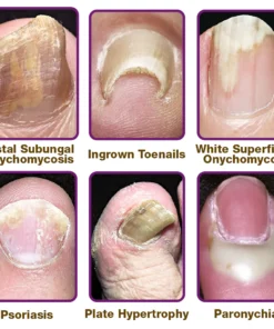 flysmus™ FungiFree Bee Venom Nail Treatment Serum