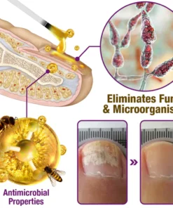 flysmus™ FungiFree Bee Venom Nail Treatment Serum