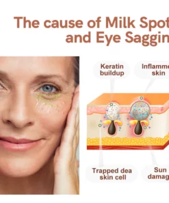 flysmus™ GoldCaviar Milk Spots Electric Serum Pen