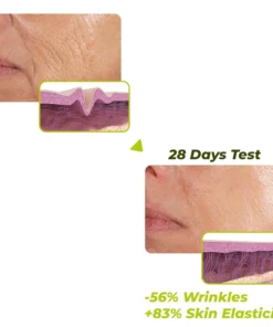 flysmus™ Resurrection Renewal Cream