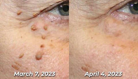 flysmus™ TagRecede Bee Venom Bioactive Compounds Spray
